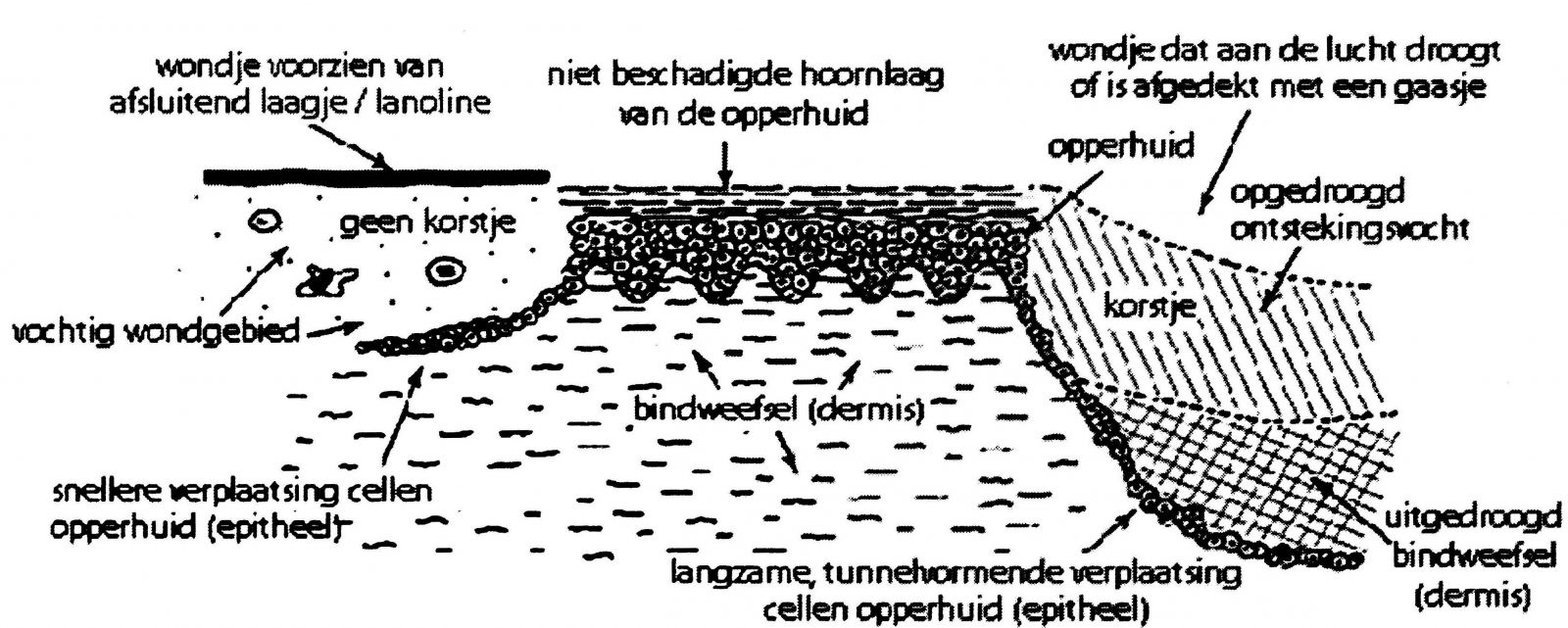 Vochtige wondgenezing